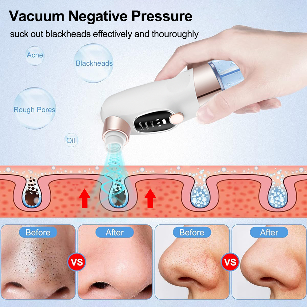 Blackhead Remover Electric Bla – Air Bubble Remover recenzja i cena